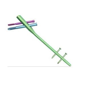 ISO13485 Orthopedic Implants  Suprapatellar Tibial Interlocking Nail