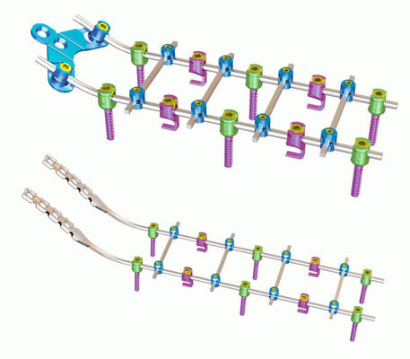 Titanium Orthopedics Posterior Cervical Fixation System