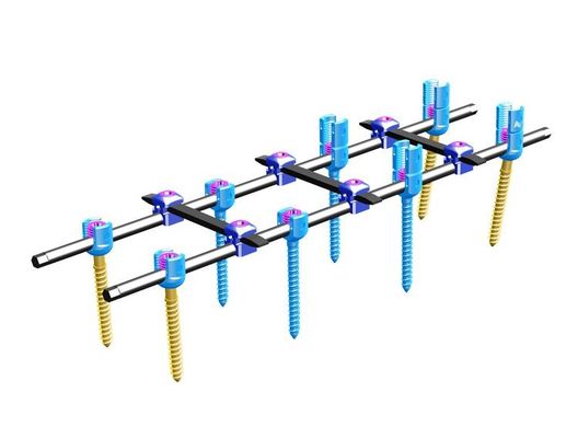 Orthopedics Spinal Internal Fixation Ⅳ Spinal Fixation System