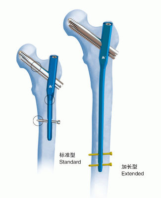 Orthopedics Titanium Gamma Interlocking Nail Ⅳ PFN