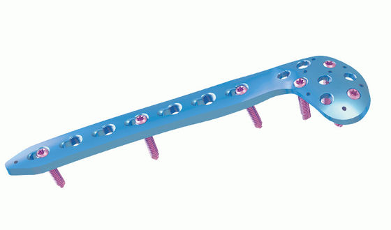 ISO CE Anterior Arch distal femoral locking plate