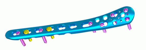 Titanium Distal Medial Tibia Plate Proximal Tibia Locking Plate