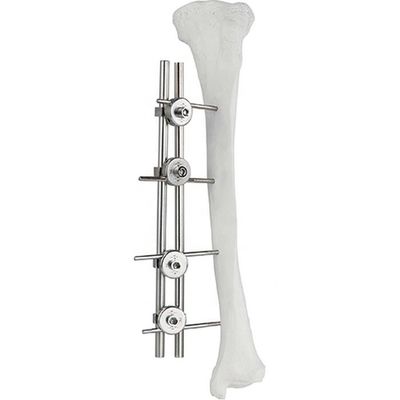 Orthopedic Implant Femur Tibial External Fixator Bone Surgery Fixator