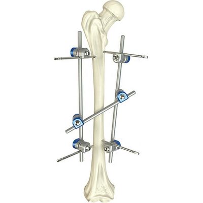 Basic Orthopedic Instrument Set Surgical Femoral Shaft External Fixation Device