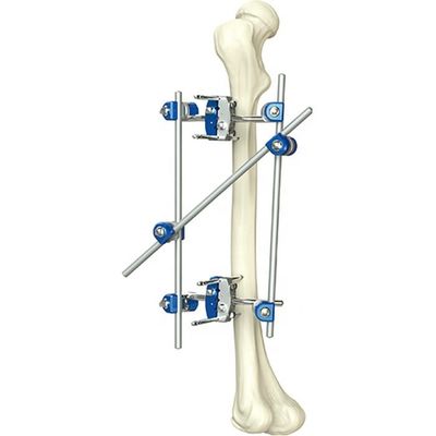 Excellent Quality Instrument Orthopedic Tibia & Percone External Fixator Orthopedic Surgical Instruments