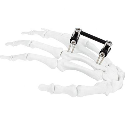 Orthopedic Surgical Mini Fragment Ilizarov External Fixation Device
