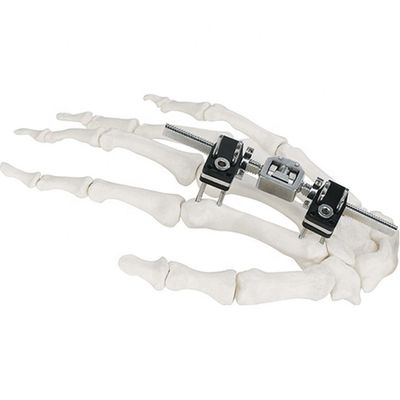 Orthopedic Surgical Mini Fragment Ilizarov External Fixation Device