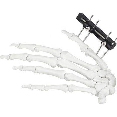 Orthopedic Surgical Mini Fragment Ilizarov External Fixation Device
