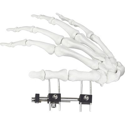 Orthopedic Surgical Mini Fragment Ilizarov External Fixation Device