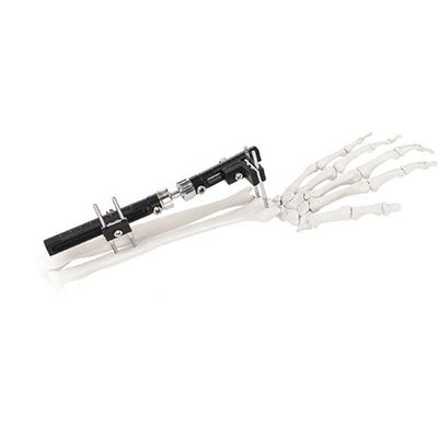 Orthopedic Surgical External Fixation Device Wrist