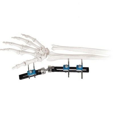 Orthopedic Surgical External Fixation Device Wrist