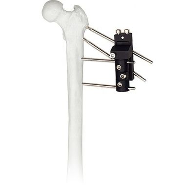 View larger image video-iconimage image Add to CompareShare Competitive Price Orthopedic Surgical Instruments Hip Joint