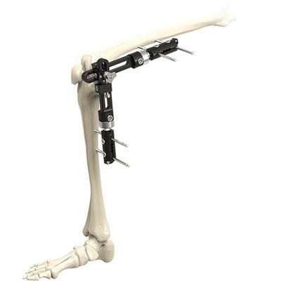 High Quality Orthopedic Surgical Instruments Knee Joint External Fixator External Fixation Orthopedic Surgical Instrumen