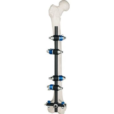 Femur Tibial External Fixator