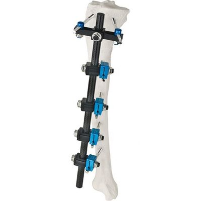 Condylar External Fixation Device