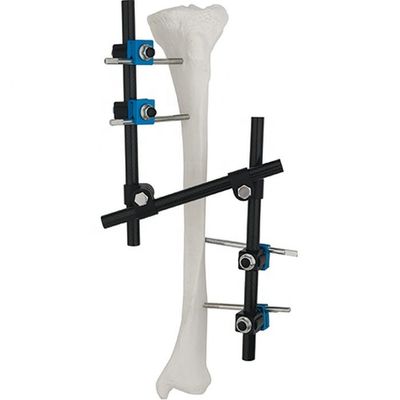 Condylar External Fixation Device