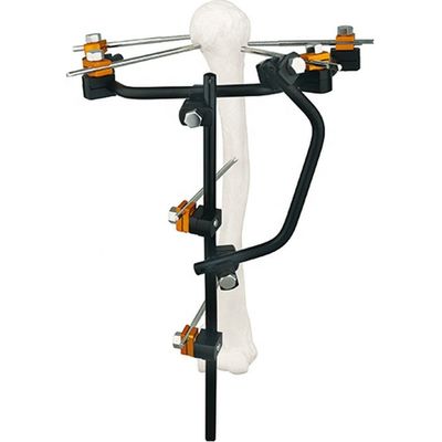 Condylar External Fixation Device