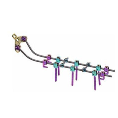 Vertebar Rods System Posterior Cervical Screws Insert Spine Fixation Device