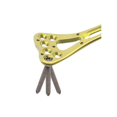 Trauma Multi Axial Palm Distal Radius Fracture Plate II