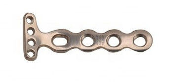 Medical Lateral Volar Locking Plate Distal Radius Orthopedic Surgery Instrument