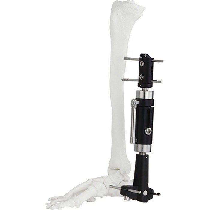 Assured Quality Orthopedic Surgical Instruments Ankle Joint Fragment External Fixator External Fixation Surgical Instrum