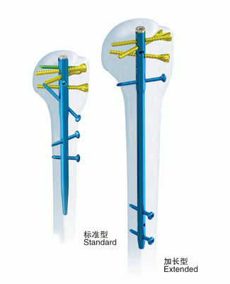 Surgical Orthopedics Anatomic Humerus Interlocking Nail